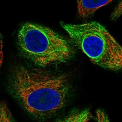 FAM131C Antibody, Novus Biologicals 25 &mu;L, Unlabeled:Antibodies, Polyclonal